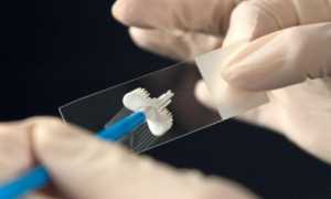 Первые признаки беременности – выделения