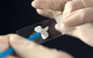 Первые признаки беременности – выделения