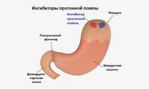 Дексилант: инструкция по применению, аналоги, отзывы