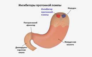 Дексилант: инструкция по применению, аналоги, отзывы