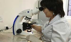 Анализ на брюшной тиф — в каких случаях и как проводится