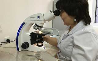 Анализ на брюшной тиф — в каких случаях и как проводится