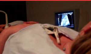 Сдача анализов после переноса эмбрионов