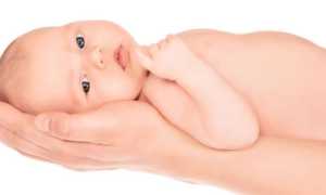 Фенилкетонурия — что это, как наследуется заболевание