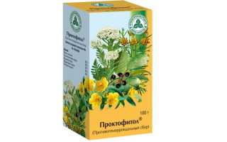 Боль в копчике — причины у мужчин и женщин, диагностика, методы лечения и возможные последствия
