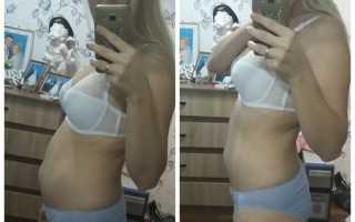 Можно ли втягивать живот при беременности и зачем?