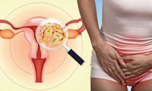 Дефицит витамина Д у женщин — причины, симптомы и лечение