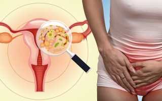 Дефицит витамина Д у женщин — причины, симптомы и лечение