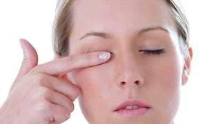 Глаукома — что это такое: симптомы и лечение