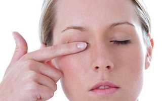 Глаукома — что это такое: симптомы и лечение