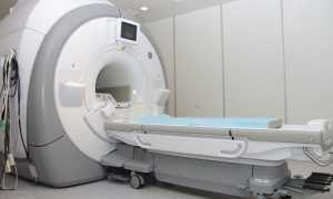 Заразен ли рак? 7 мифов про заболевание