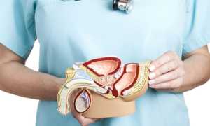 Воспаление простаты – симптомы и лечение медикаментозными и народными средствами, методы профилактики