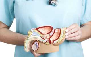 Воспаление простаты – симптомы и лечение медикаментозными и народными средствами, методы профилактики