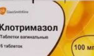 Что такое молочница и какие причины её возникновения