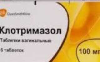 Что такое молочница и какие причины её возникновения