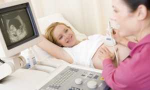 Скрининг при беременности — что это?