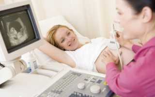 Скрининг при беременности — что это?
