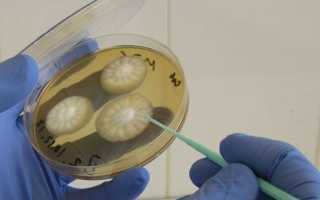 Грибковые заболевания: симптомы, лечение и профилактика