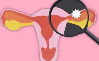 Возможны ли занятия сексом при внематочной беременности и после нее?