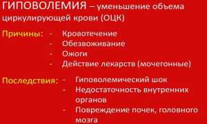 Пониженное давление и учащенный пульс – причины патологические и медикаментозные