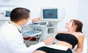 УЗИ для определения беременности: срок в неделях