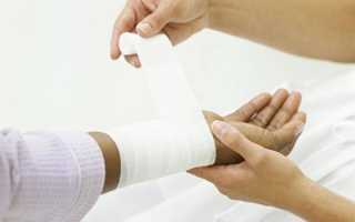 Облепиховое масло от ожогов