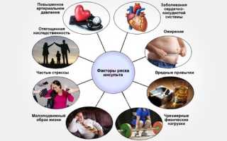 Ишемический инсульт головного мозга — причины, симптомы и лечение