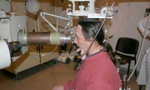 Как лечить базалиому кожи носа облучением и народными средствами