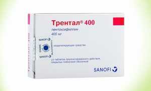 Лечение артрита пальцев рук медикаментами — список препаратов с ценами