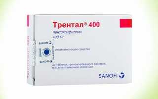 Лечение артрита пальцев рук медикаментами — список препаратов с ценами