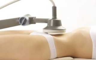 Лечение острого бартолинита медикаментами и народными средствами