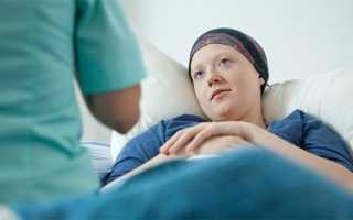 Что такое химиотерапия — список препаратов и схема проведения