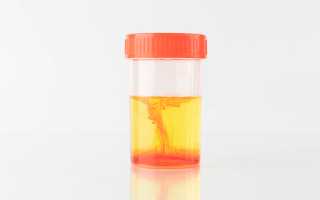 Эритроциты в моче эритроциты при беременности