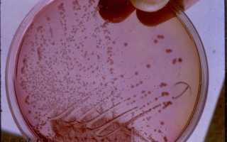 Чем опасен фекальный энтерококк при беременности, лечение и профилактика