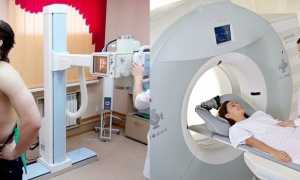 Гайморотомия — ход операции, последствия и восстановление