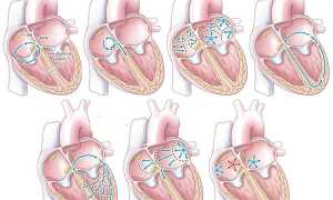 Аритмия и тахикардия: чем отличаются заболевания
