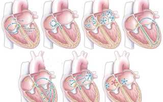 Аритмия и тахикардия: чем отличаются заболевания