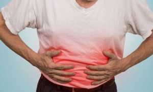 Жжение в желудке — причины и опасные симптомы, диагностика, методы терапии и профилактика
