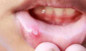 Листья брусники – лечебные свойства и противопоказания, отвар и настои