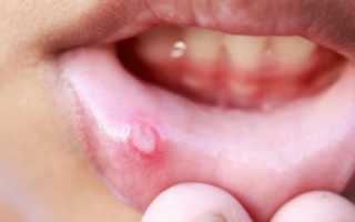 Листья брусники – лечебные свойства и противопоказания, отвар и настои