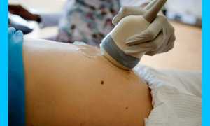 Базальная температура при внематочной беременности