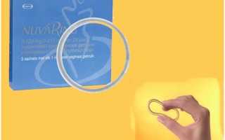 НоваРинг – эффективное средство от эндометриоза