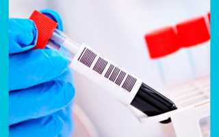 Анализ крови на ХГЧ: назначение и расшифровка