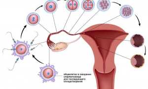 Женское бесплодие