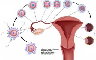 Женское бесплодие