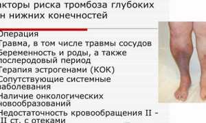 Тромбоз глубоких вен нижних конечностей — симптомы и лечение