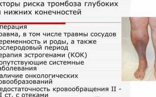 Тромбоз глубоких вен нижних конечностей — симптомы и лечение
