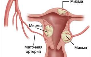 Что такое искусственный климакс: для чего он нужен?