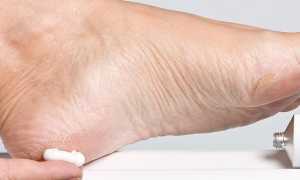 Цинковая мазь от грибка — инструкция по применению