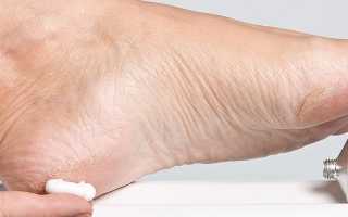 Цинковая мазь от грибка — инструкция по применению